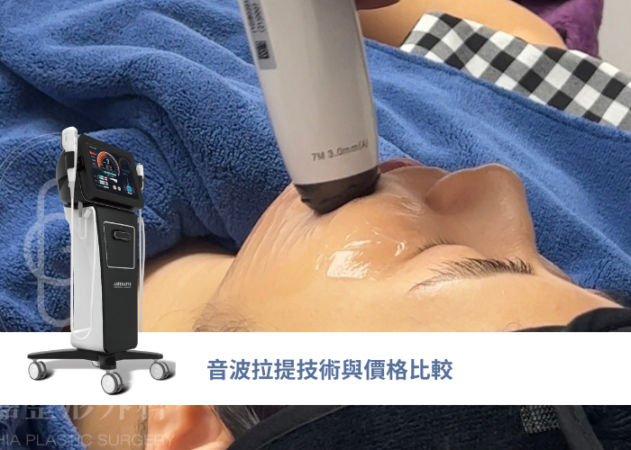 音波拉提技術與價格比較：Ultherapy、HIFU、Liftera2和Sofwave...